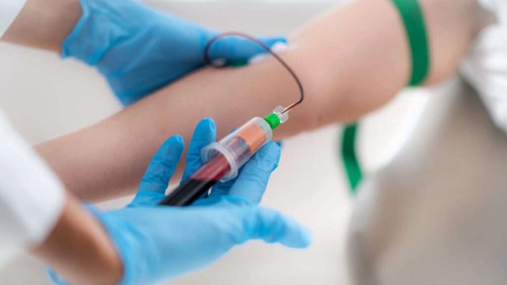 Impact of PRP on Erectile Dysfunction​