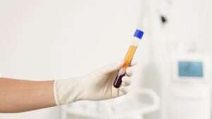 What is Platelet-Rich Plasma (PRP)?​