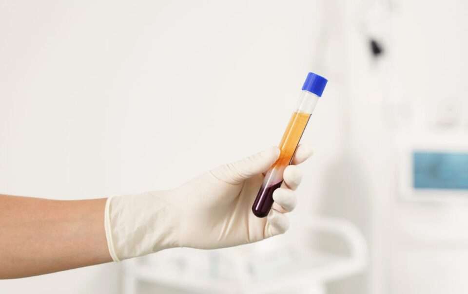 What is Platelet-Rich Plasma (PRP)?​